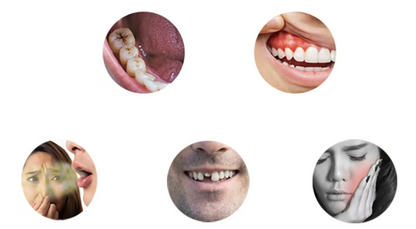 TLOPA®  (BDA recommended)Hydroxyapatite Toothpaste(🦷𝐋𝐢𝐦𝐢𝐭𝐞𝐝 𝐭𝐢𝐦𝐞 𝐝𝐢𝐬𝐜𝐨𝐮𝐧𝐭 𝐋𝐚𝐬𝐭 𝟑𝟎 𝐦𝐢𝐧𝐮𝐭𝐞𝐬🦷)💧